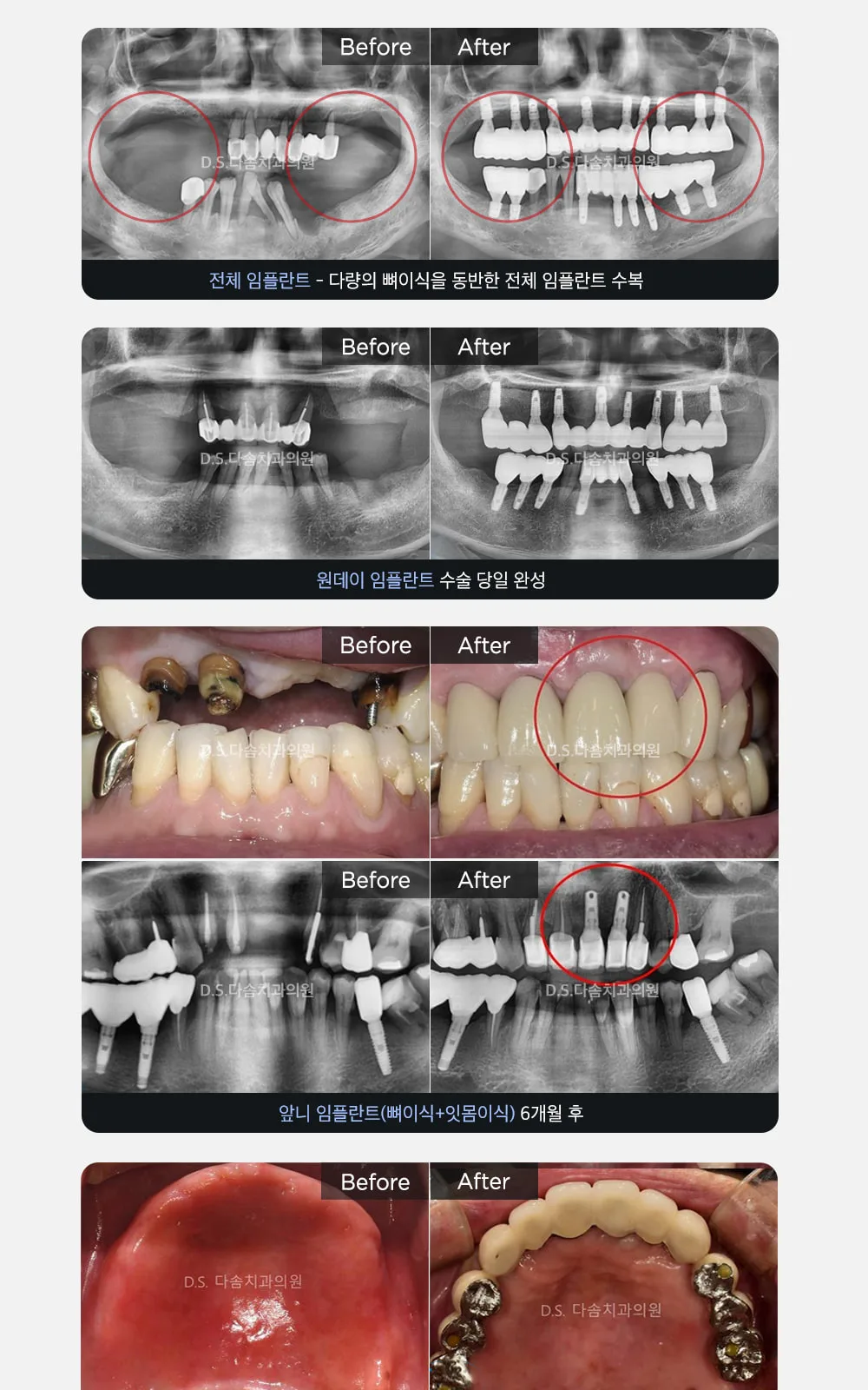 시술 상세 7