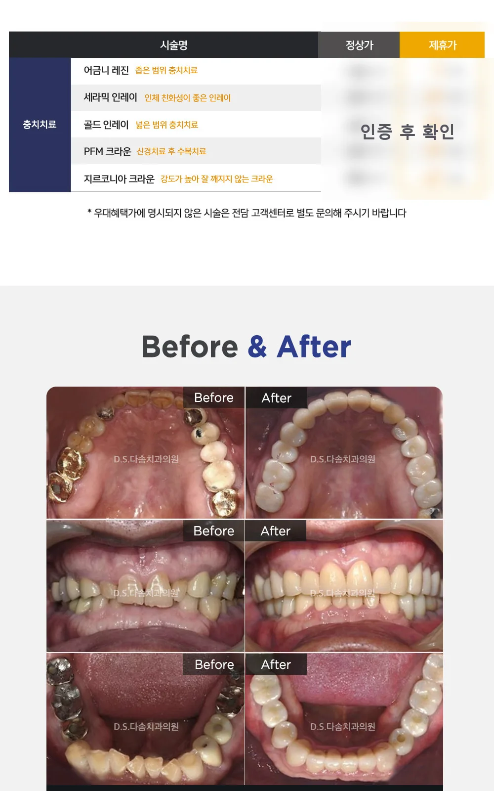 시술 상세 5