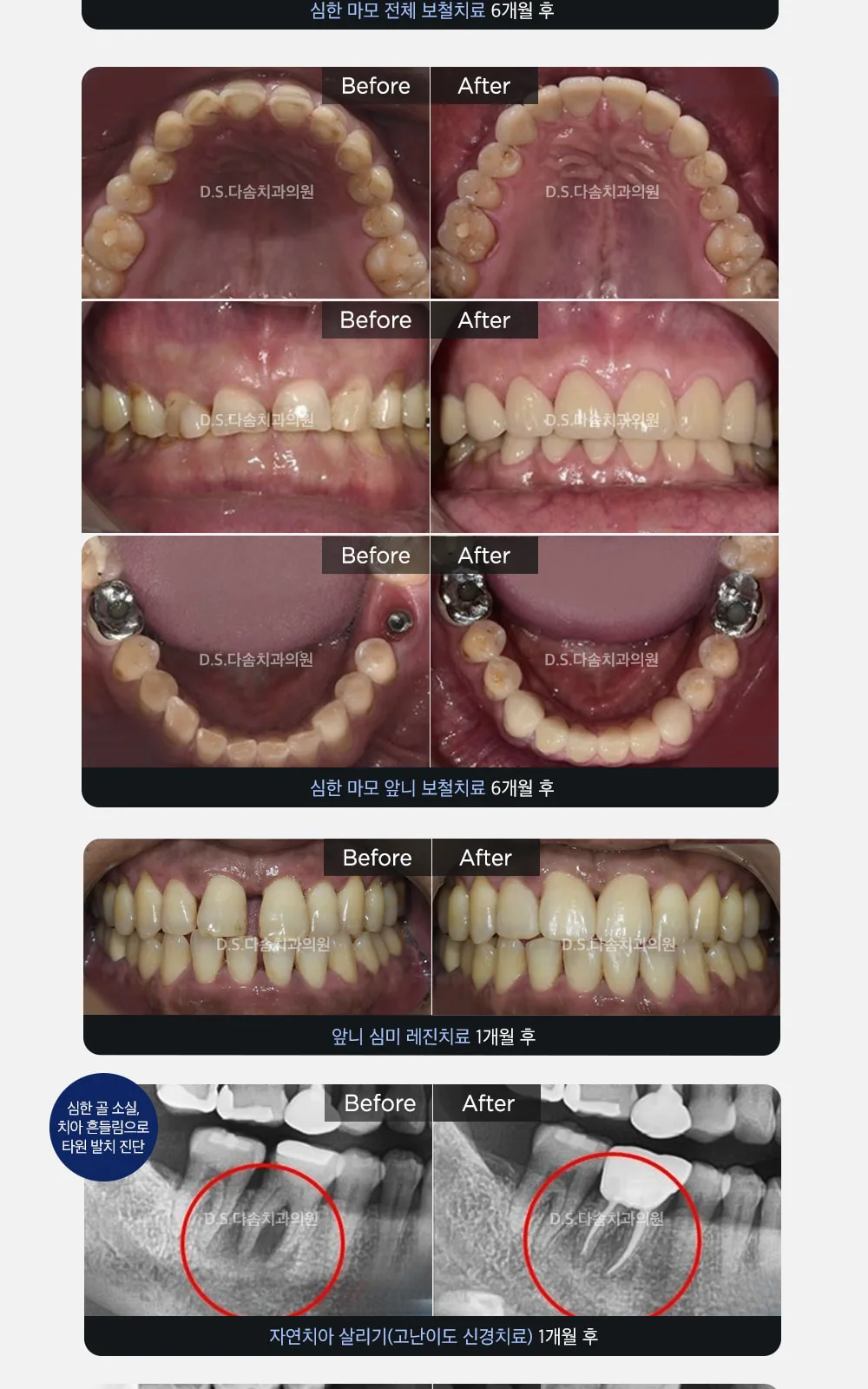 시술 상세 6