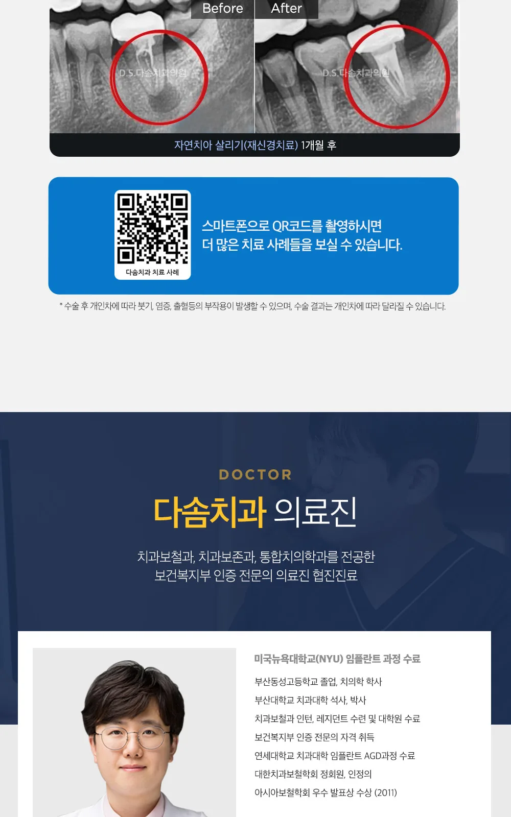 시술 상세 7