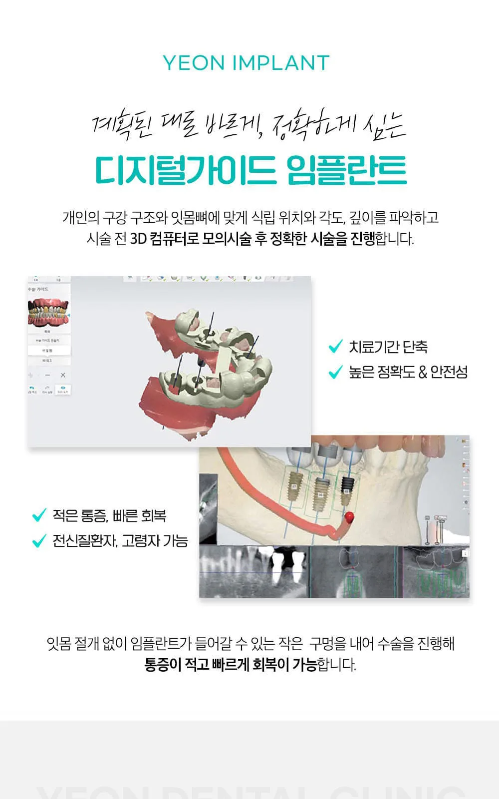 시술 상세 5
