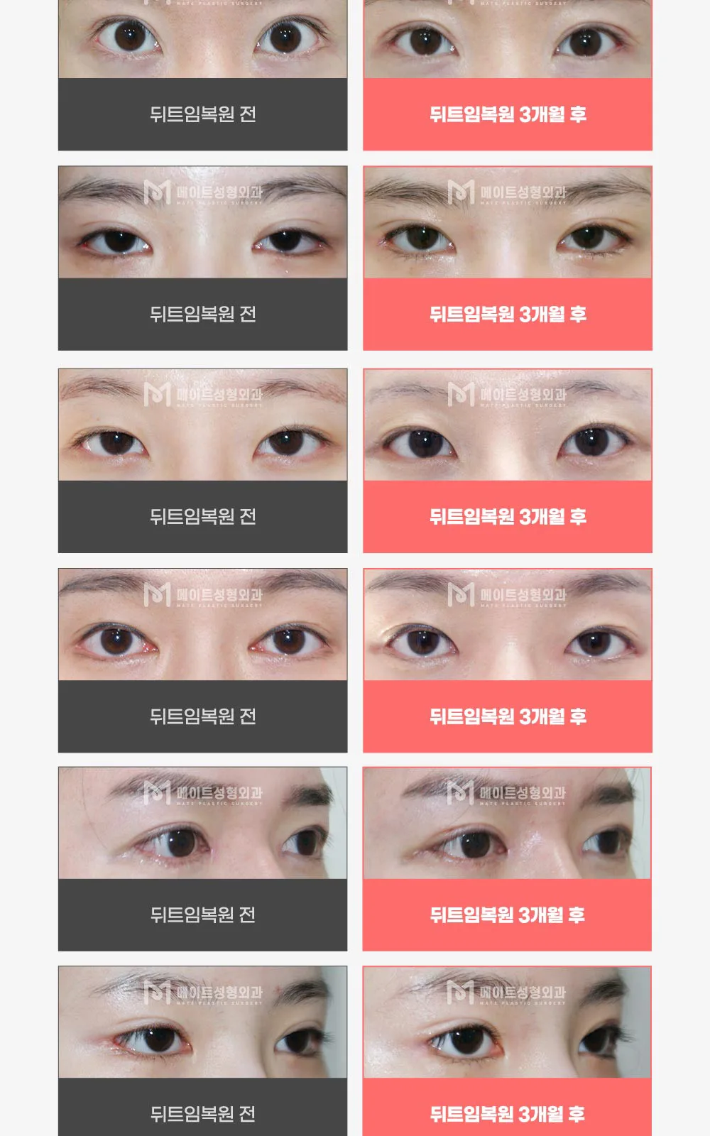 시술 상세 7