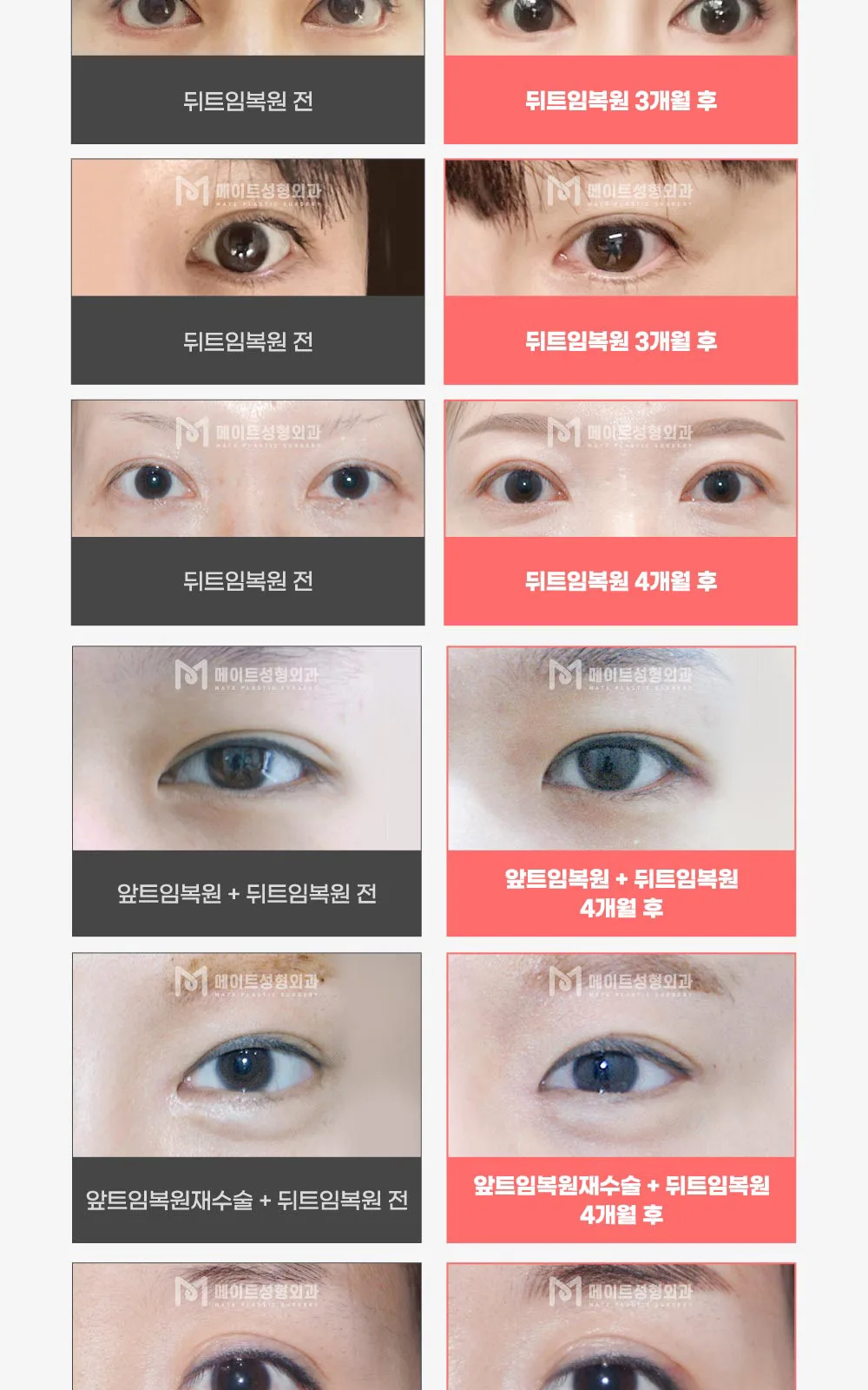 시술 상세 9