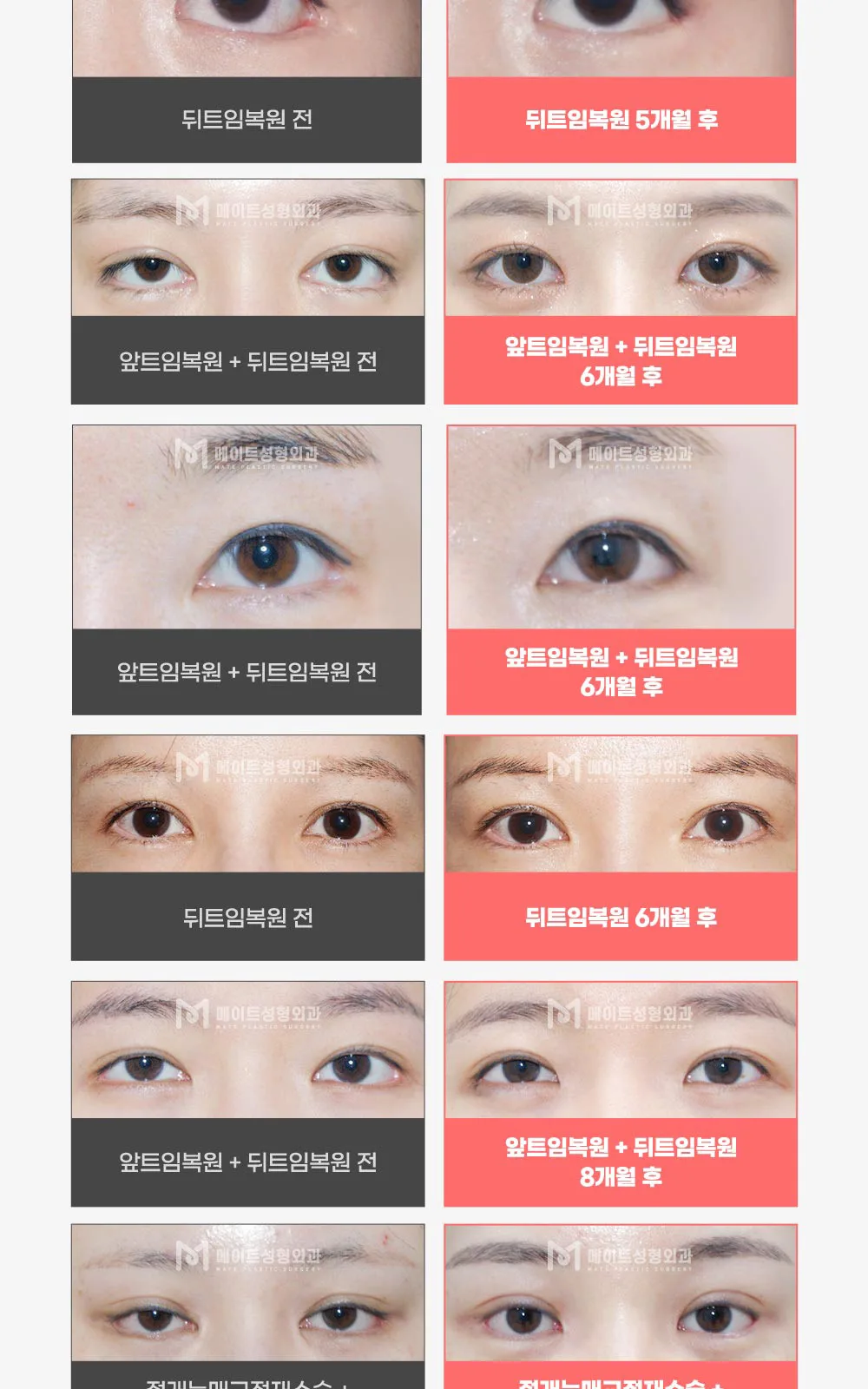 시술 상세 10