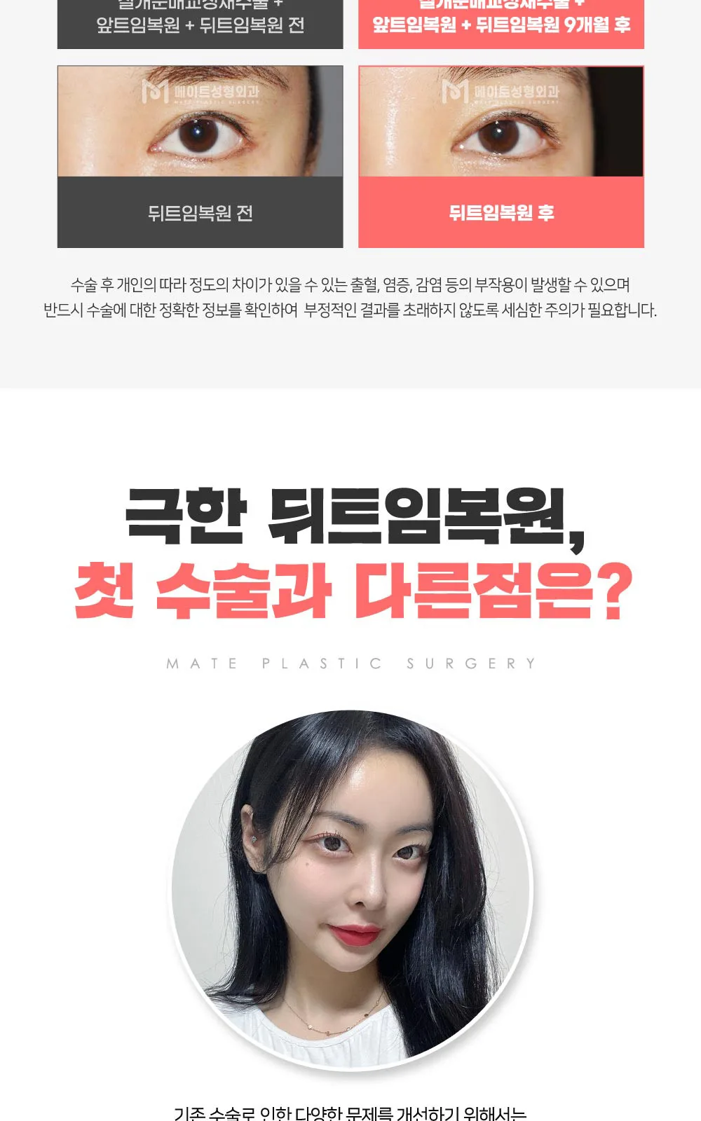 시술 상세 11
