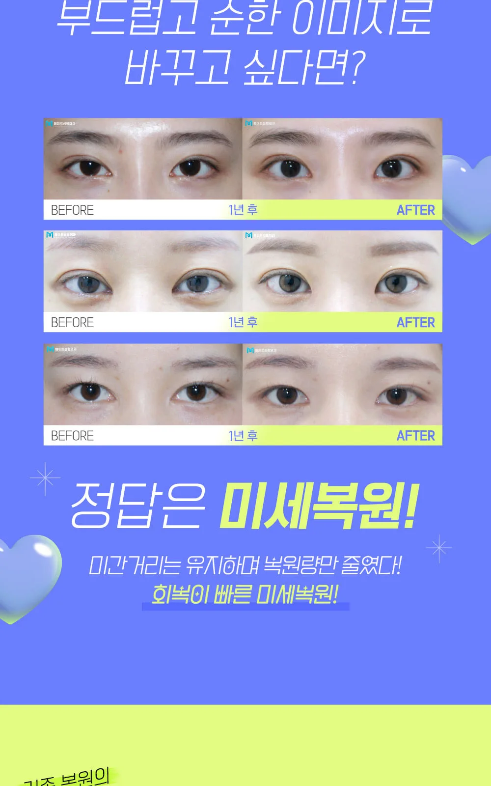 시술 상세 2