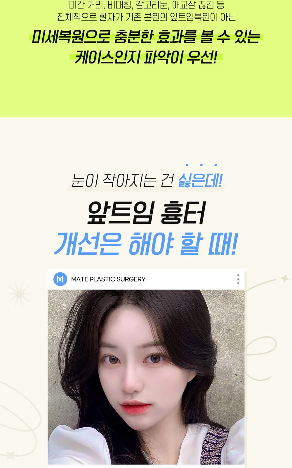 시술 상세 4