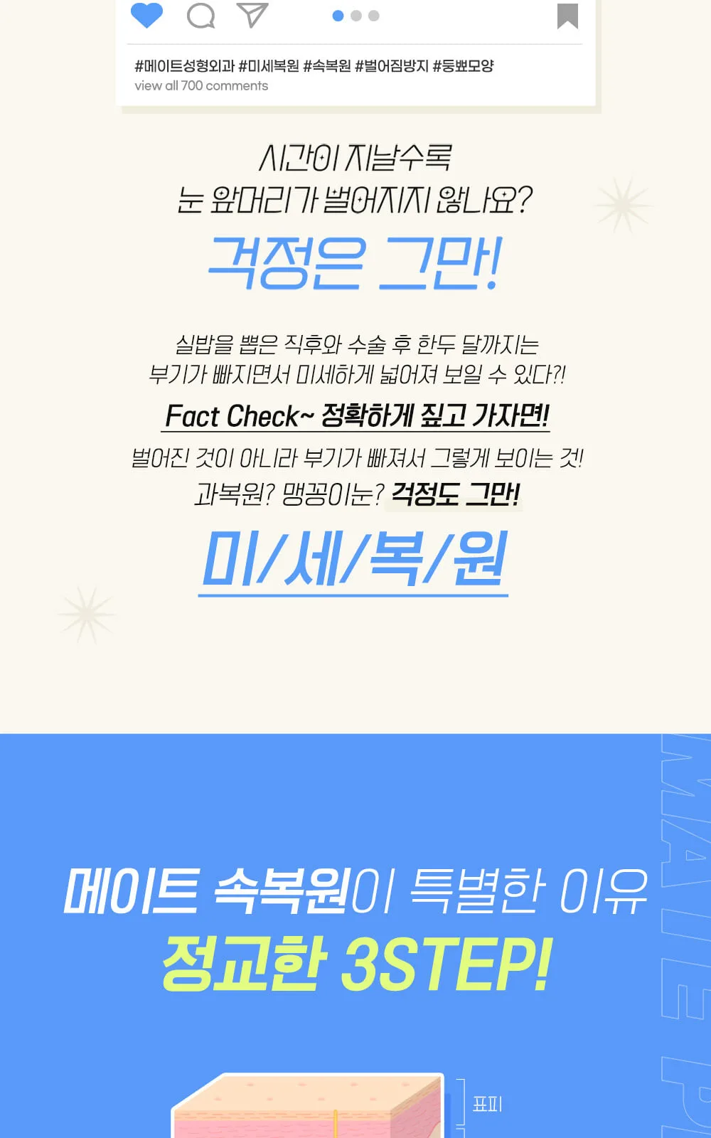 시술 상세 5