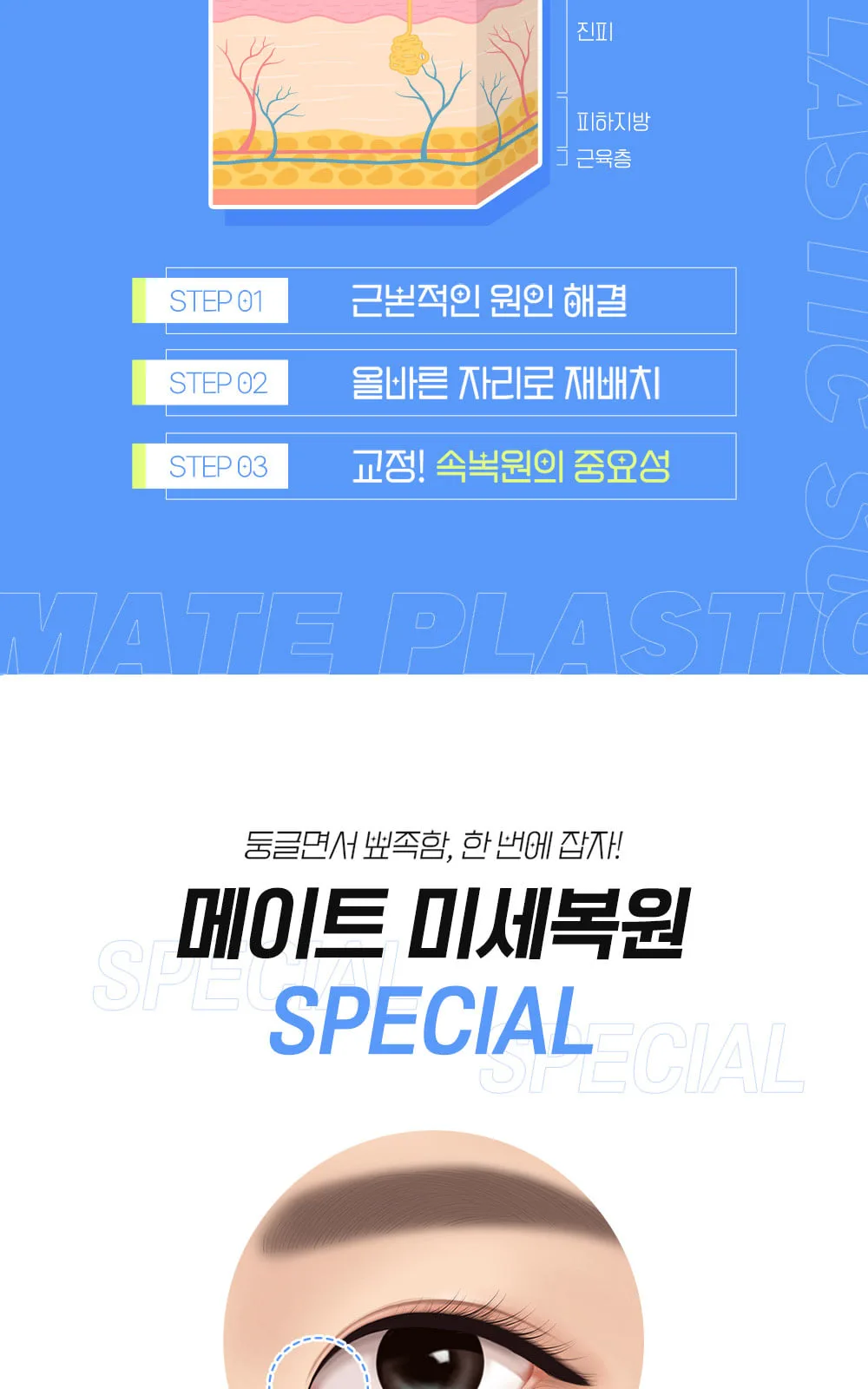 시술 상세 6