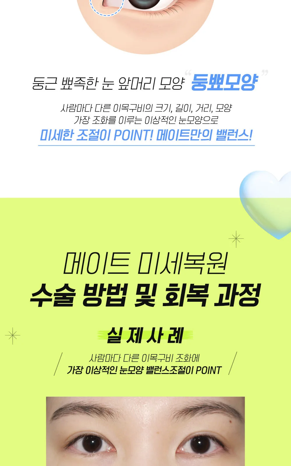시술 상세 7
