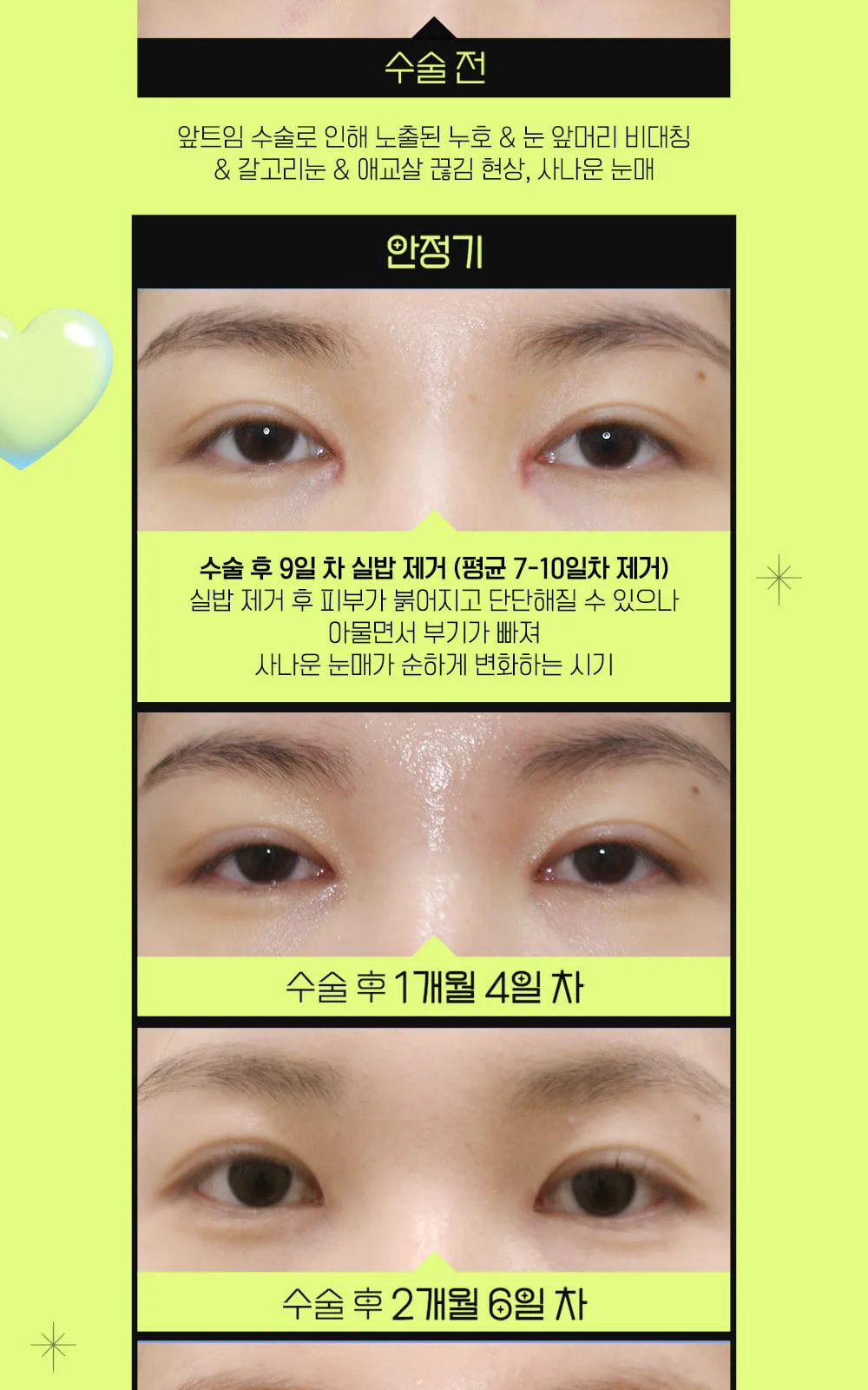 시술 상세 8