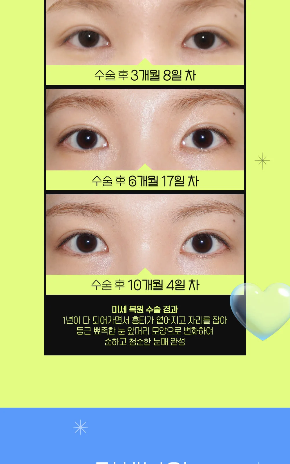 시술 상세 9