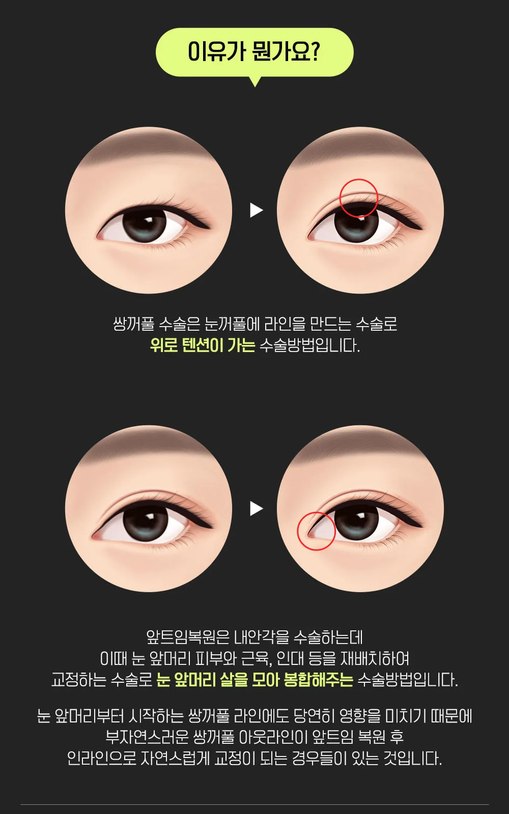 시술 상세 11