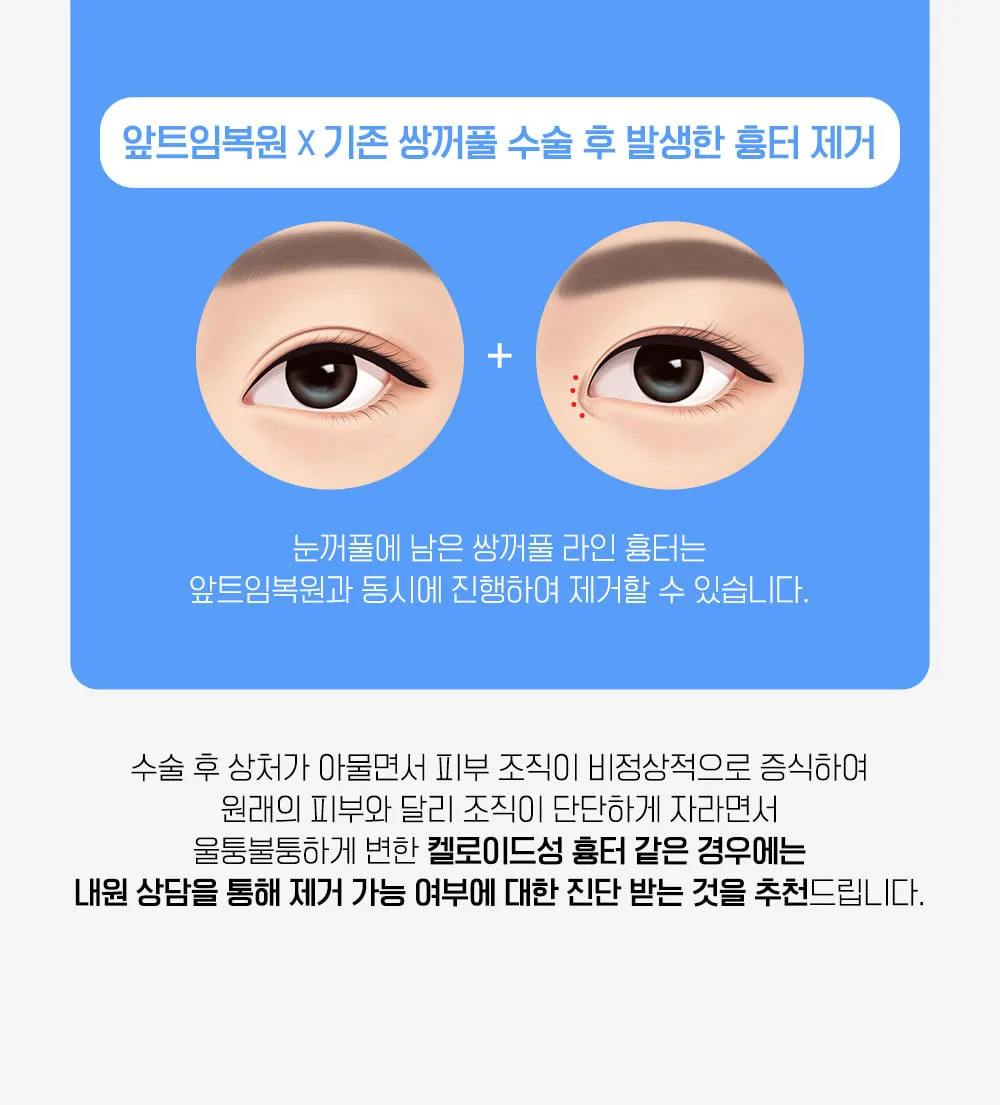 시술 상세 14