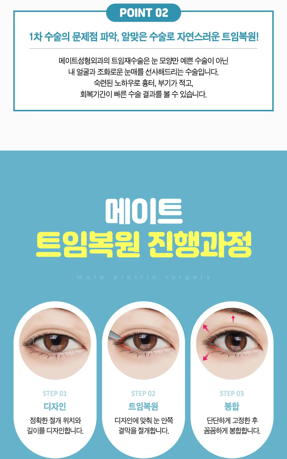 시술 상세 3