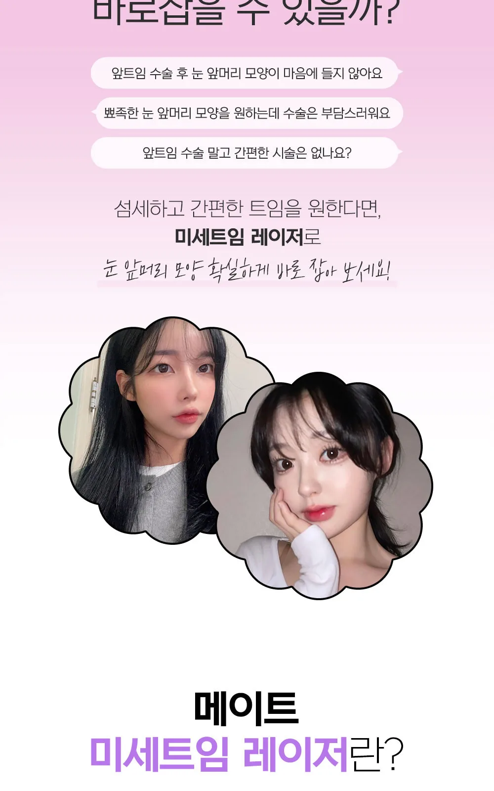시술 상세 2
