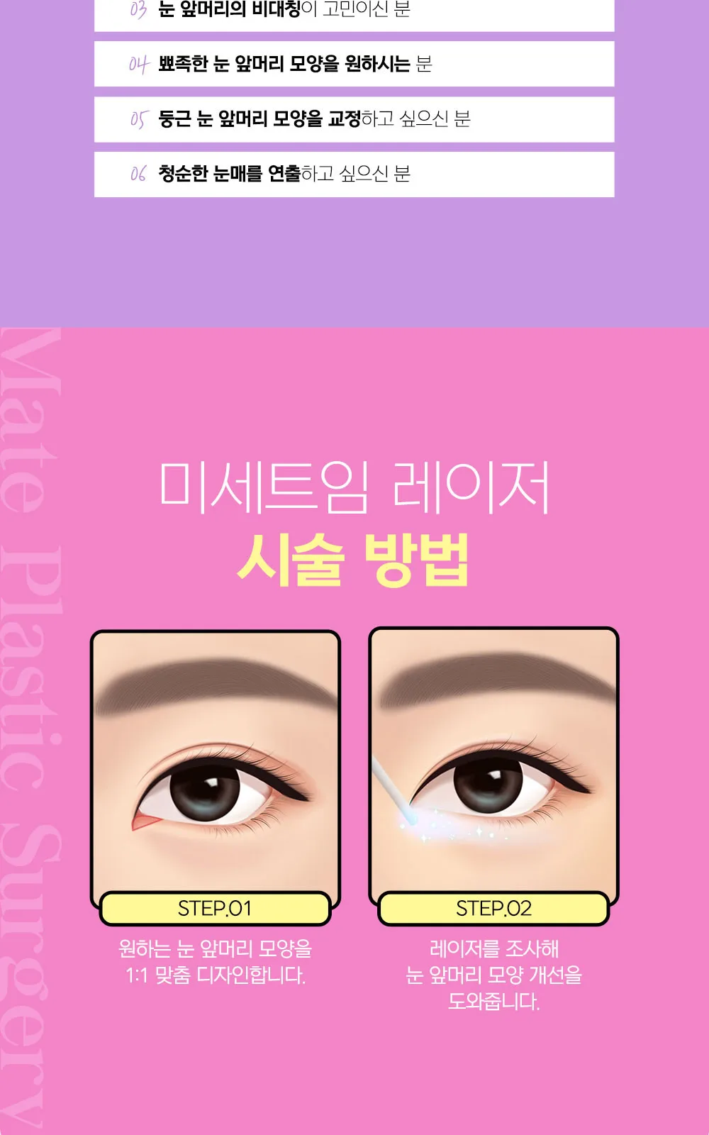 시술 상세 4