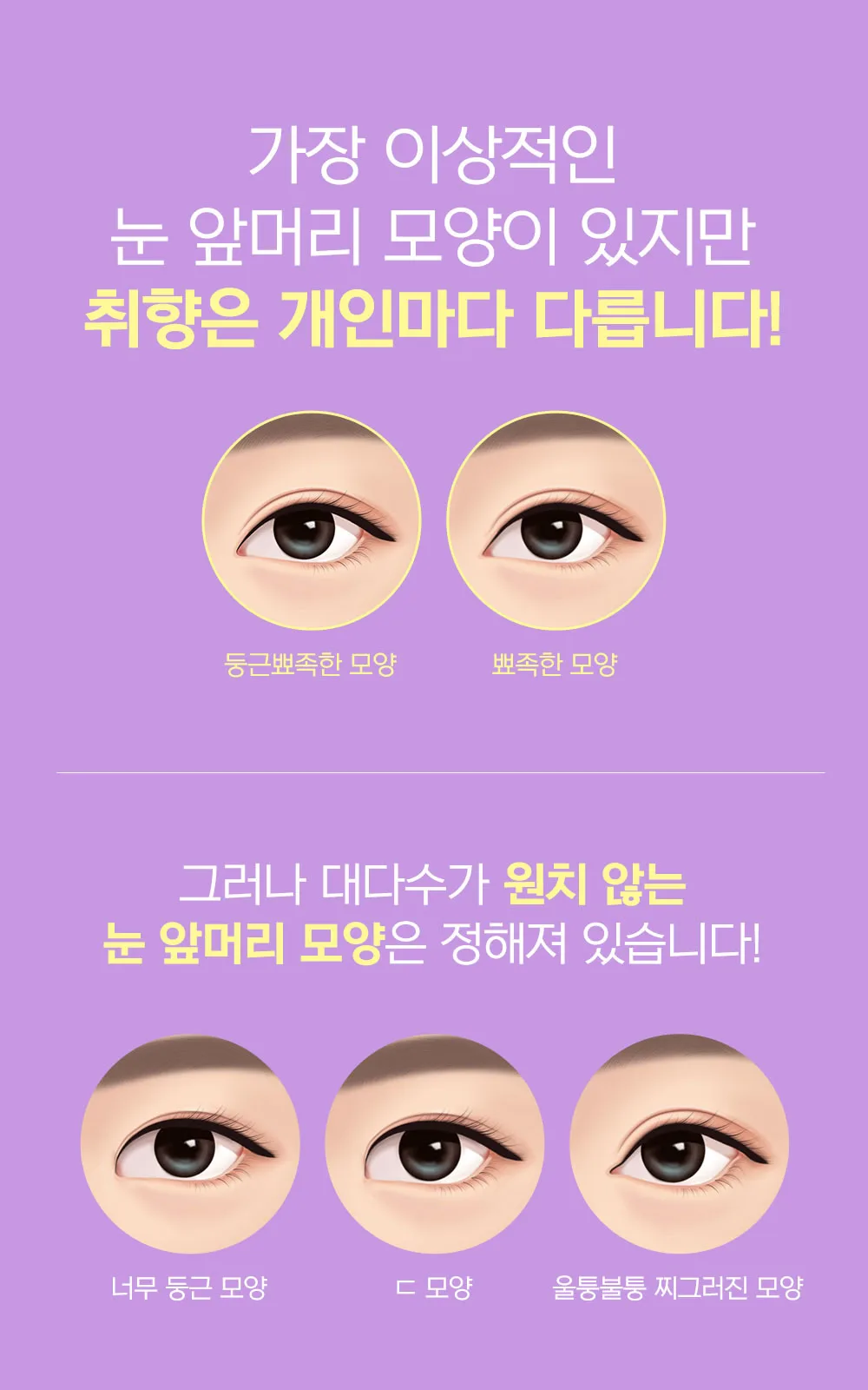 시술 상세 8