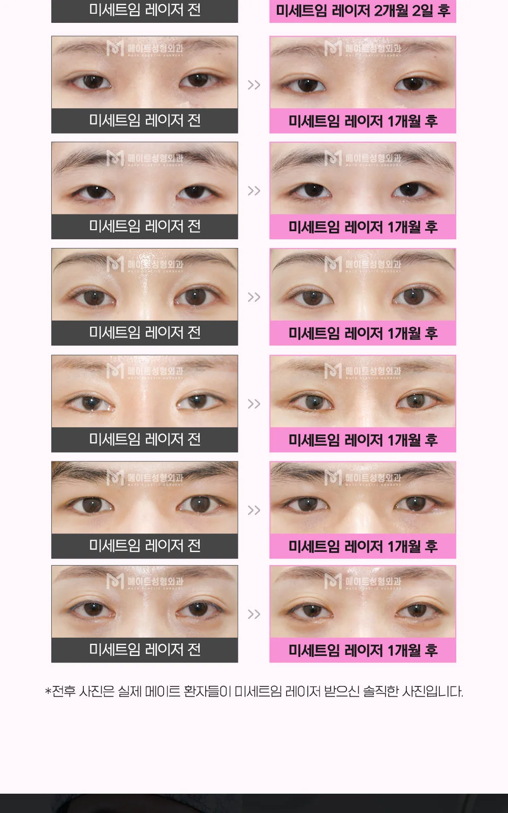 시술 상세 19