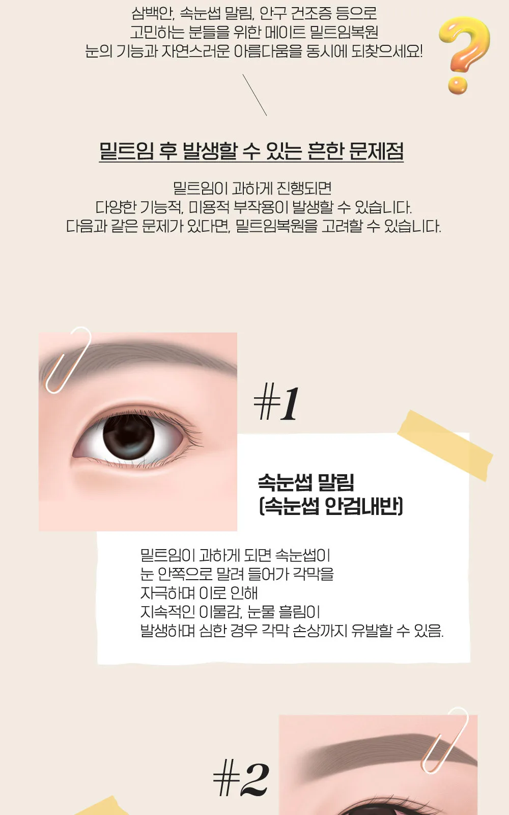 시술 상세 2
