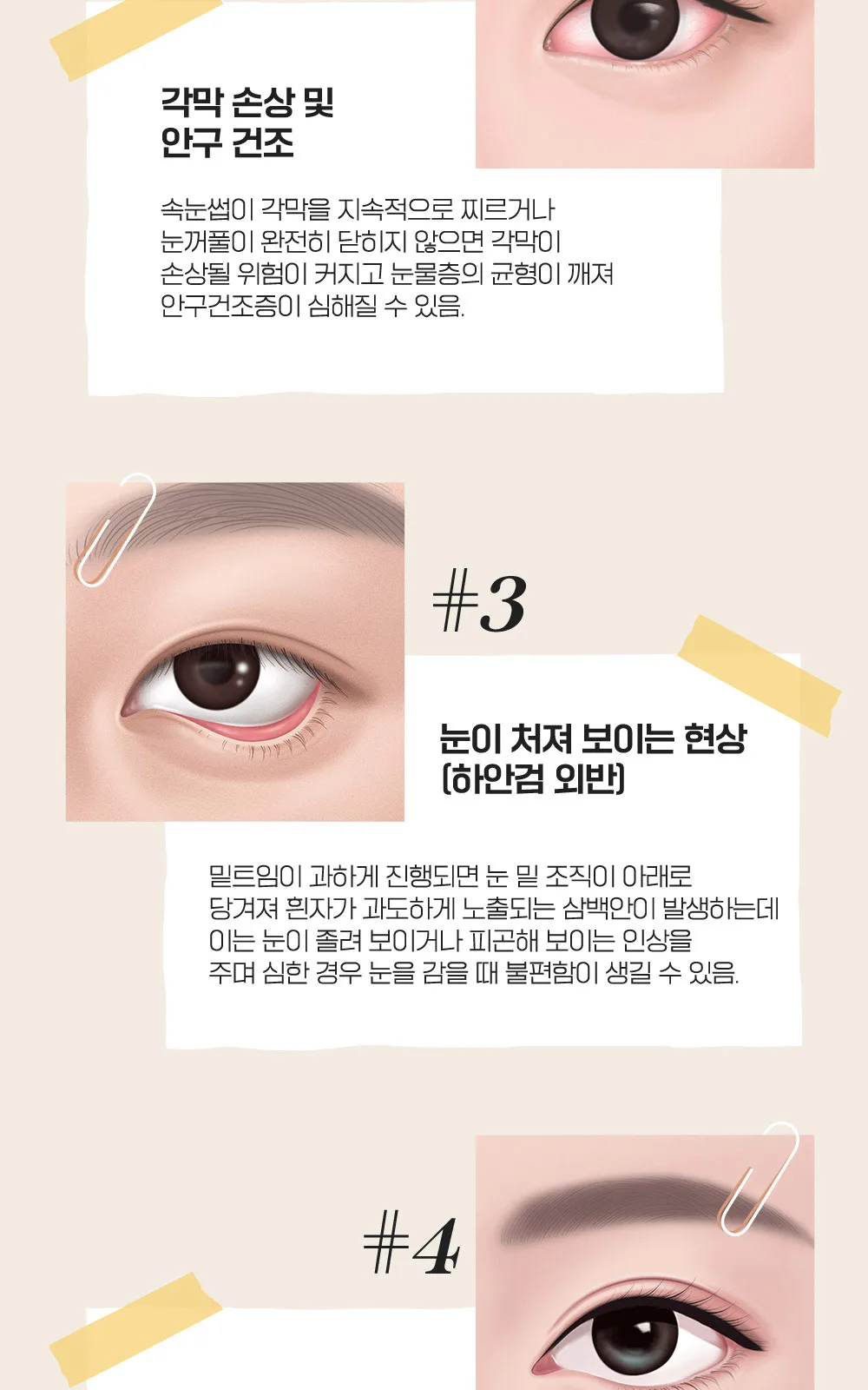 시술 상세 3