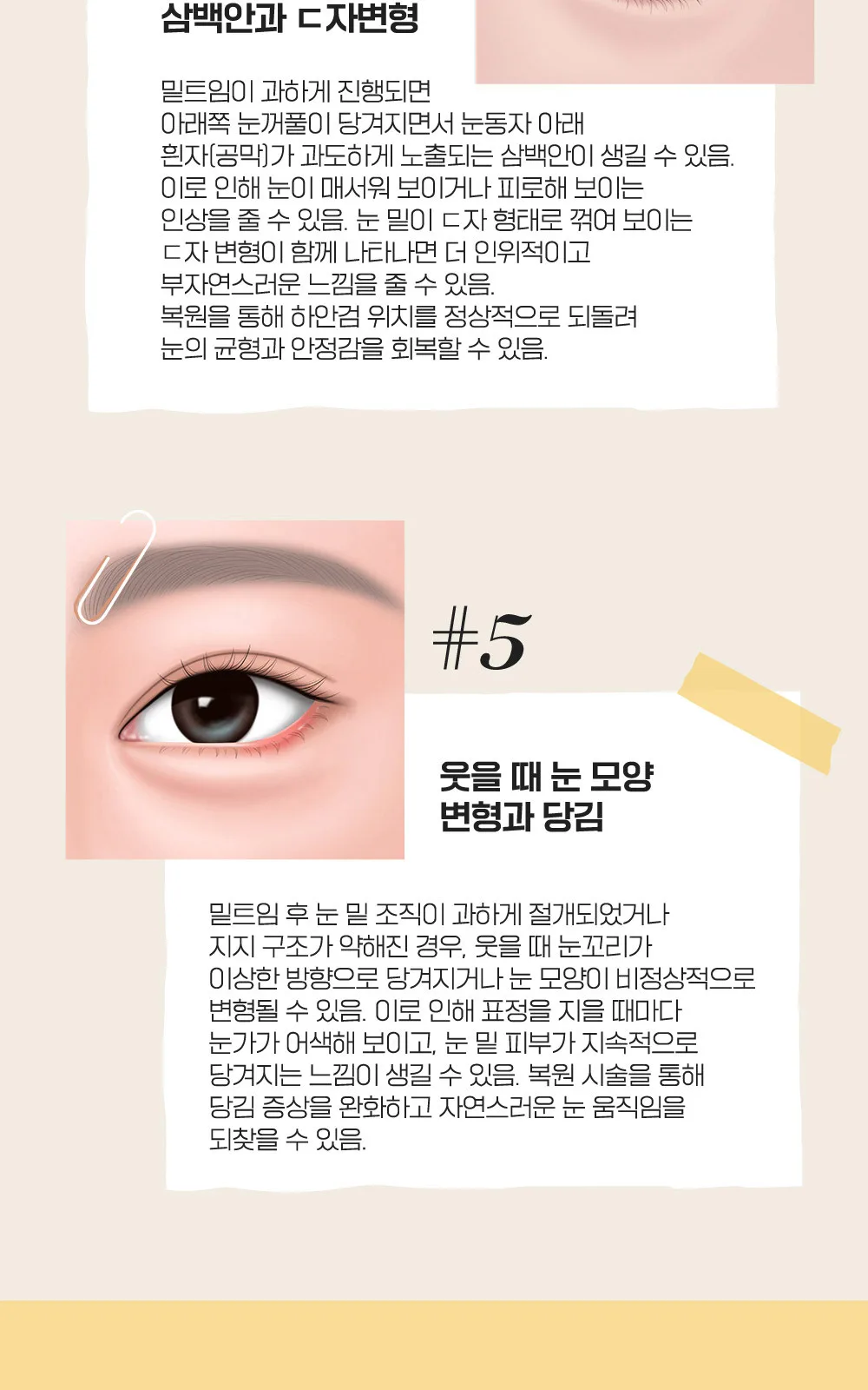 시술 상세 4