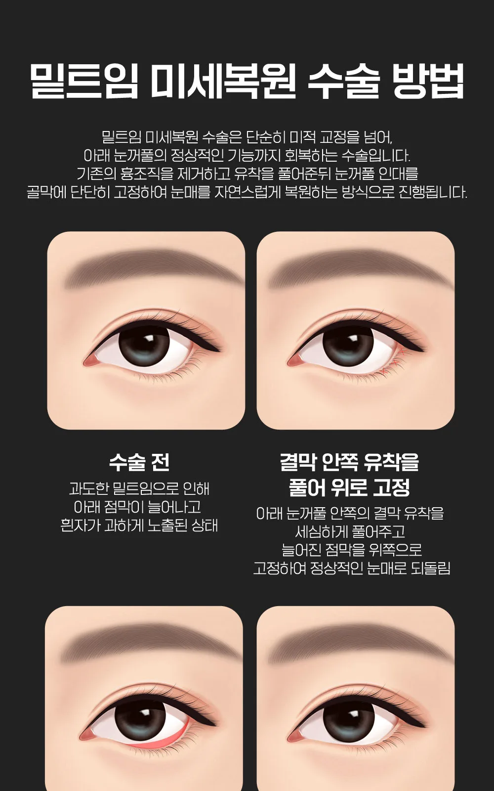 시술 상세 6