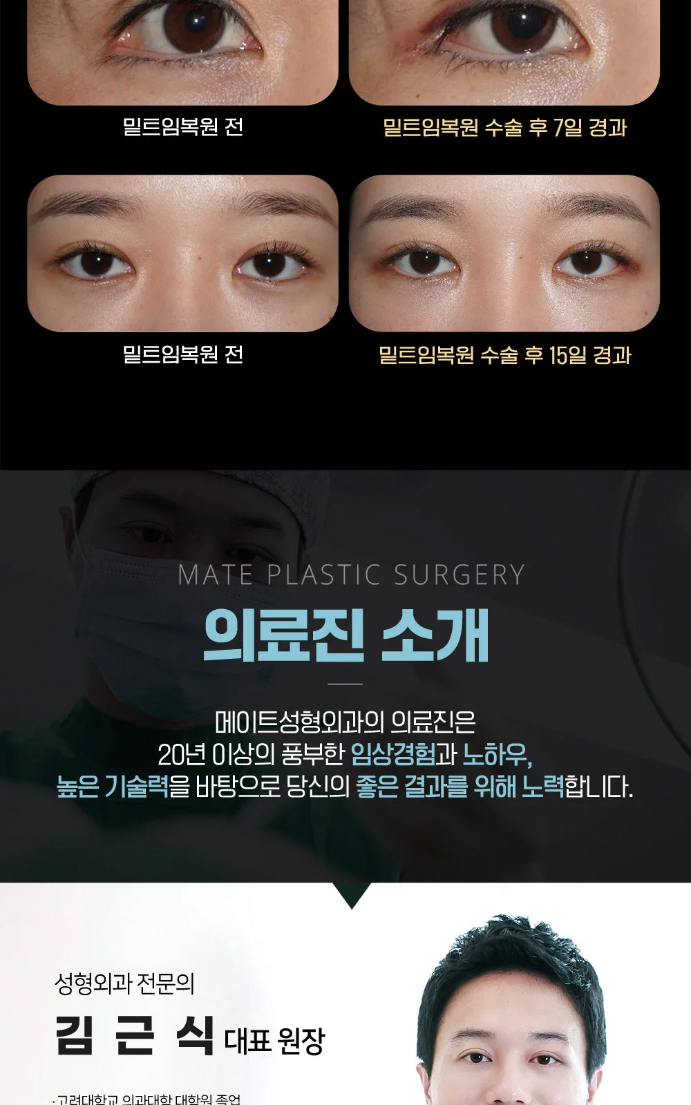 시술 상세 9