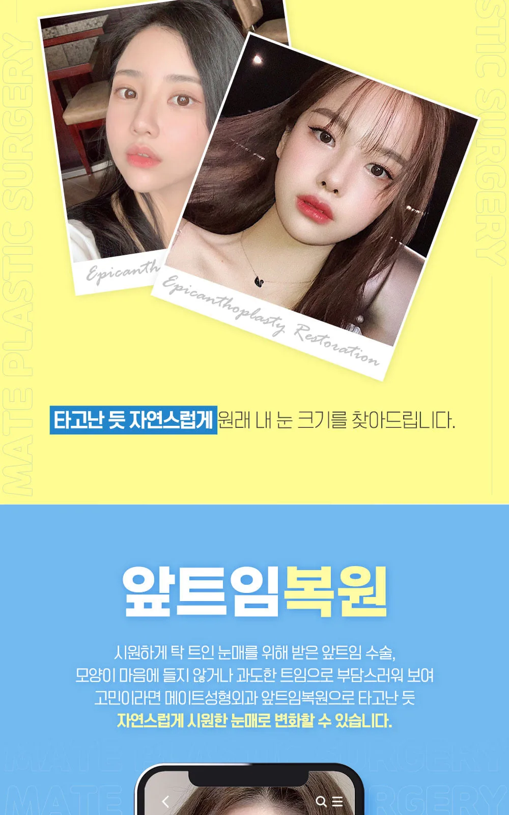 시술 상세 2