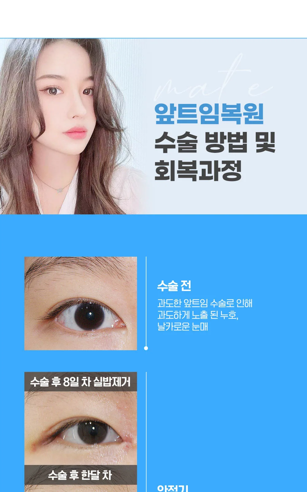 시술 상세 4