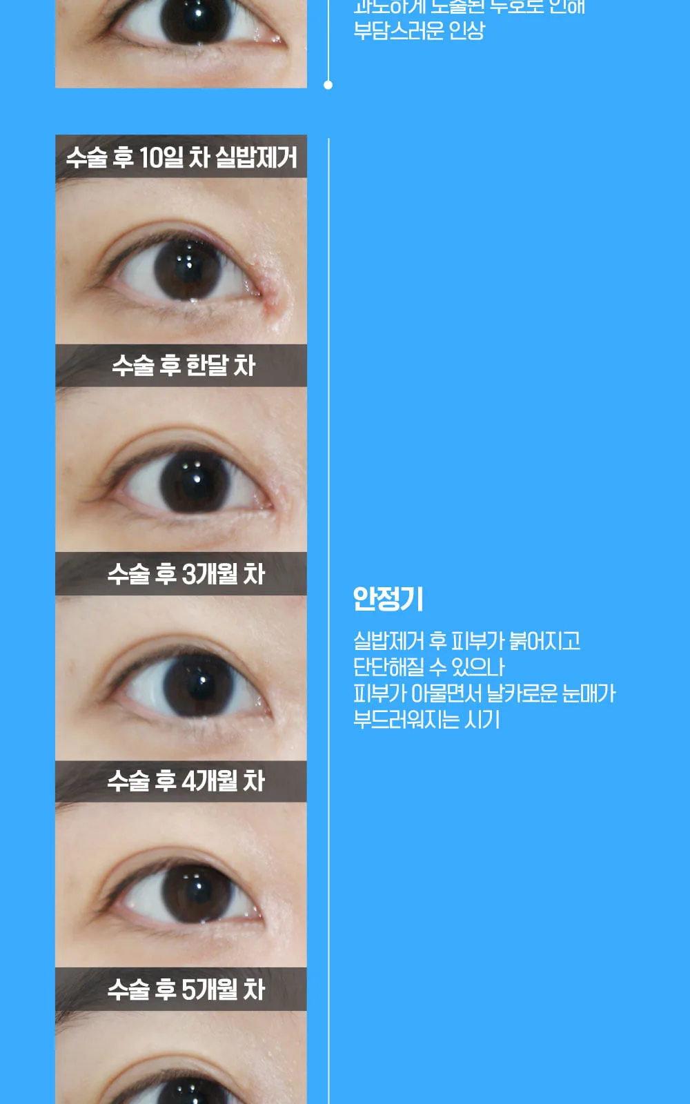 시술 상세 6