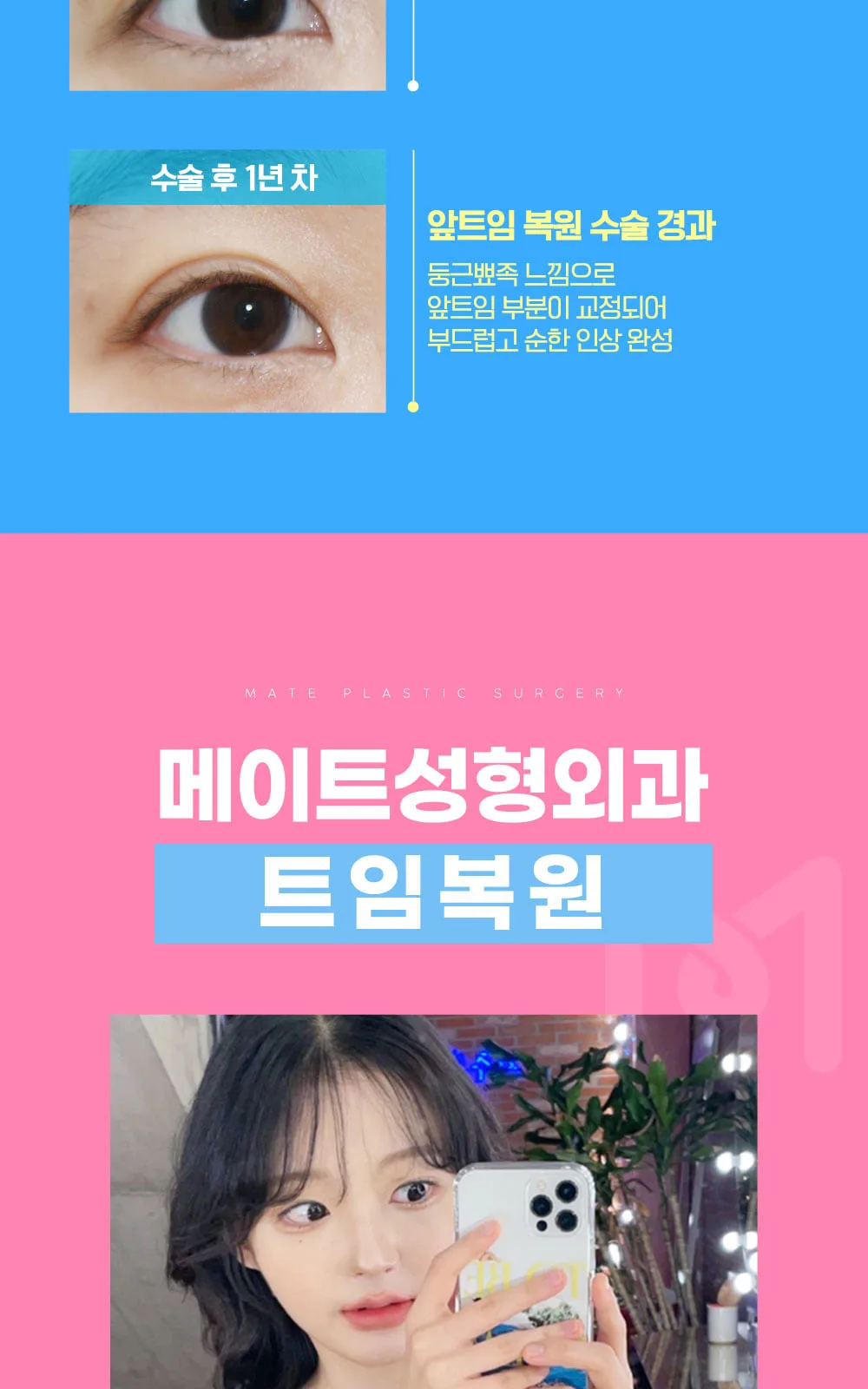 시술 상세 7