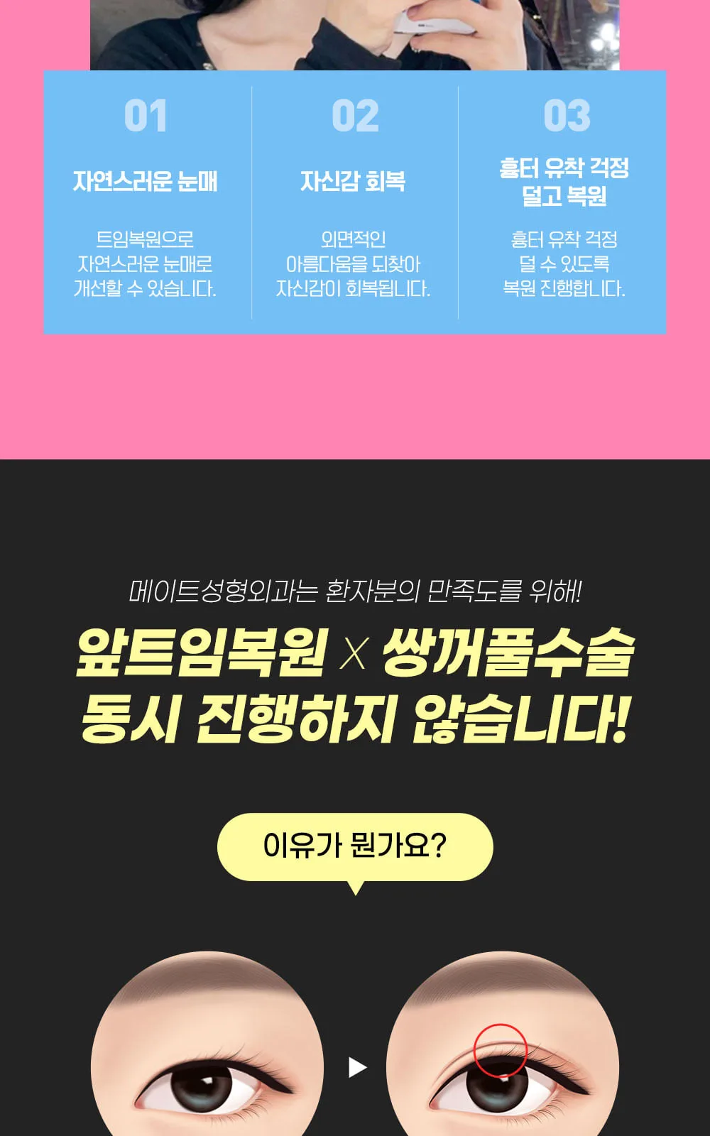시술 상세 8