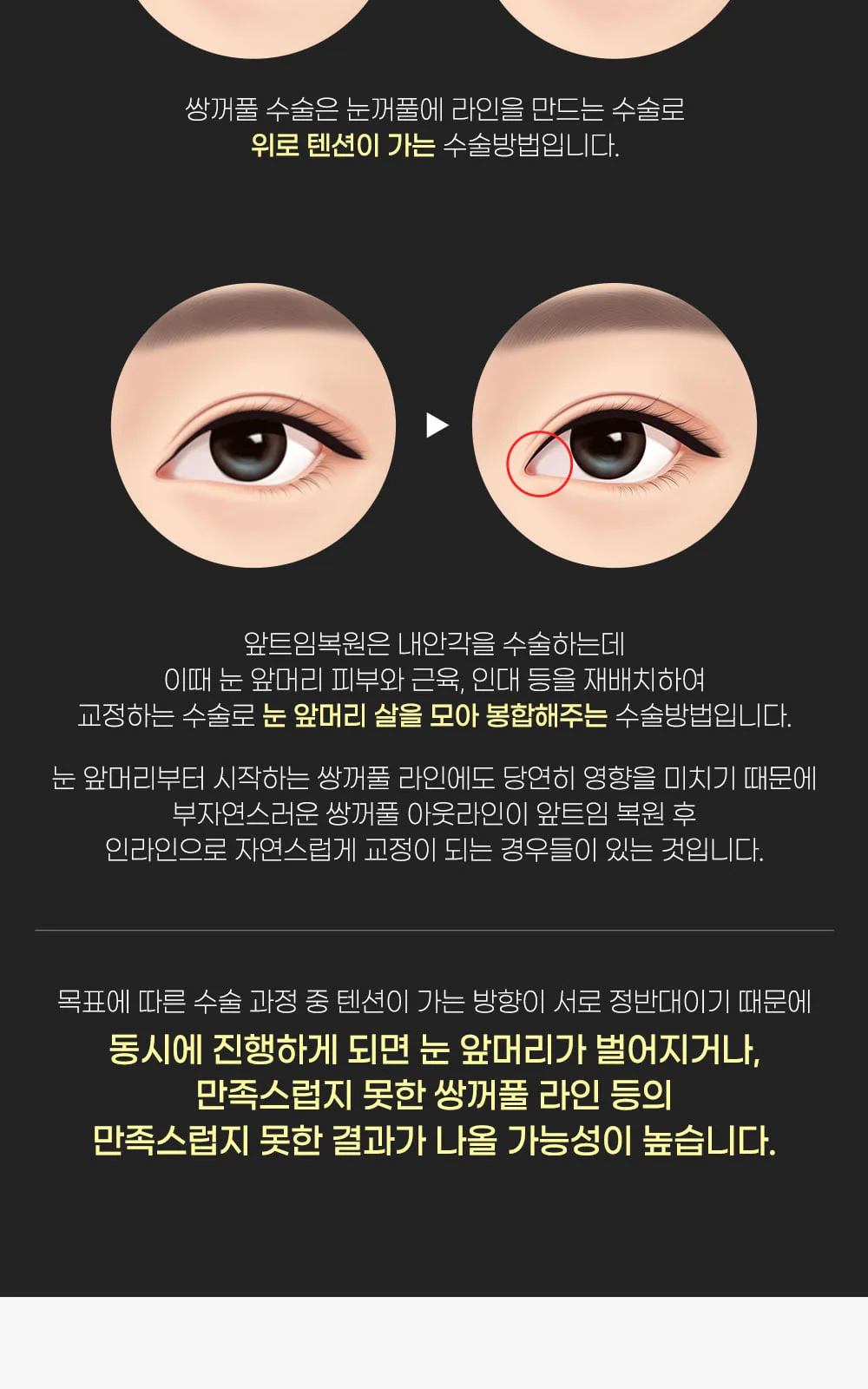 시술 상세 9