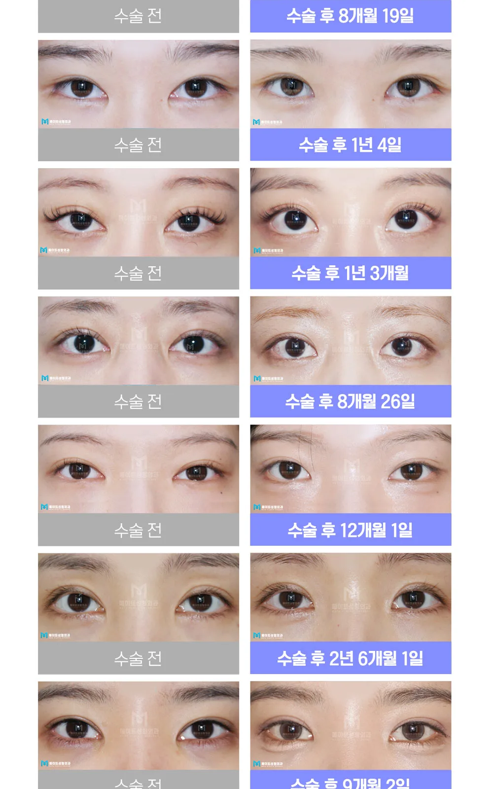 시술 상세 19