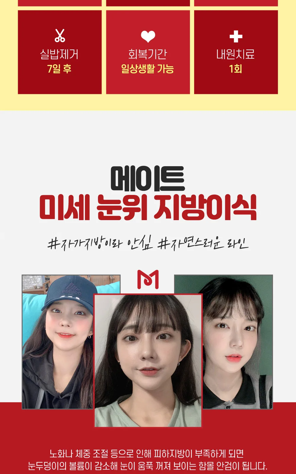 시술 상세 2