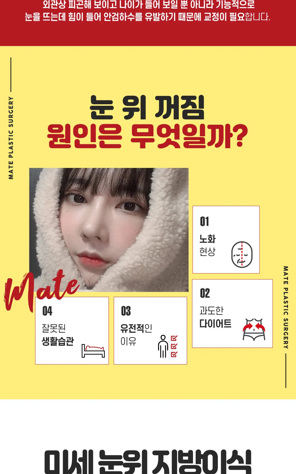 시술 상세 3