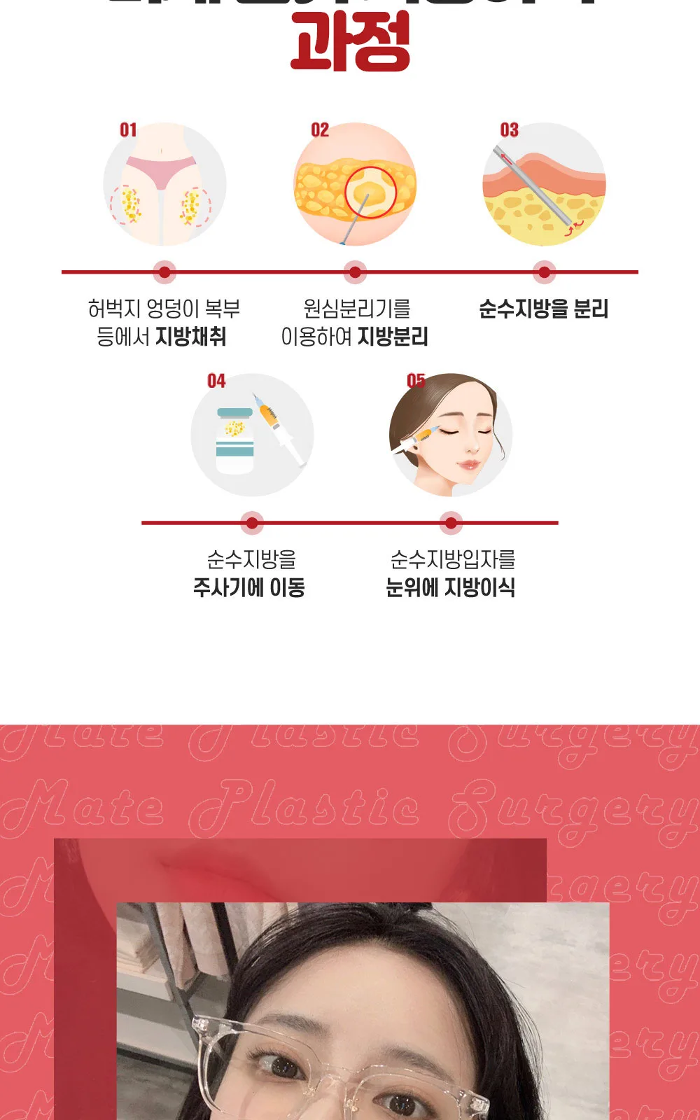 시술 상세 4