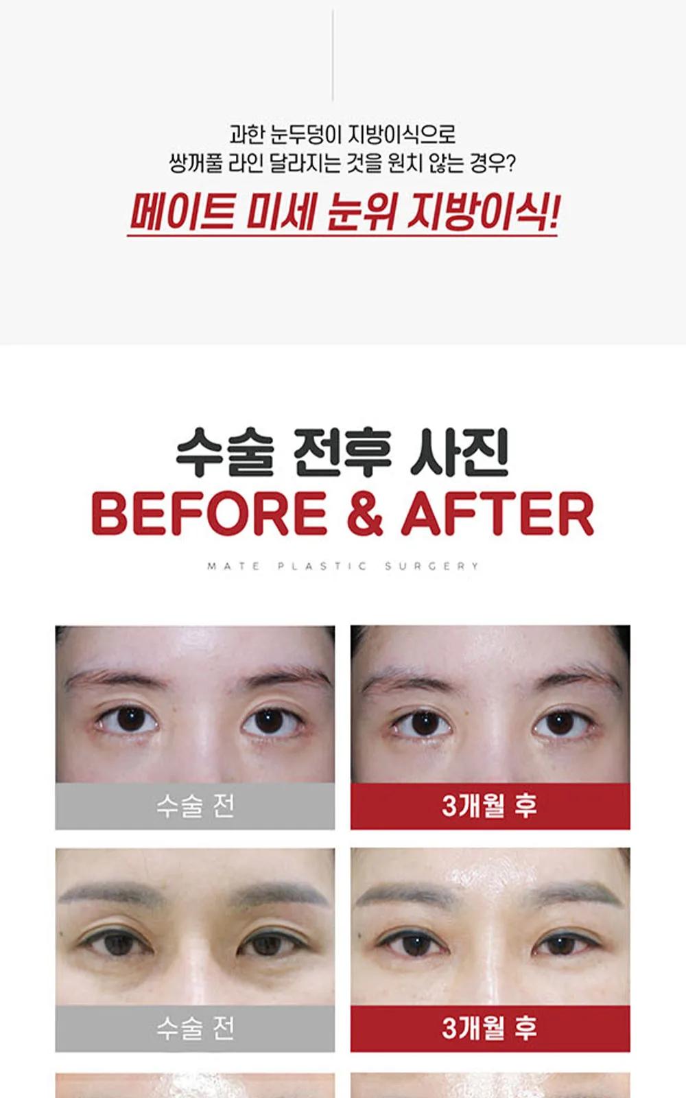시술 상세 7
