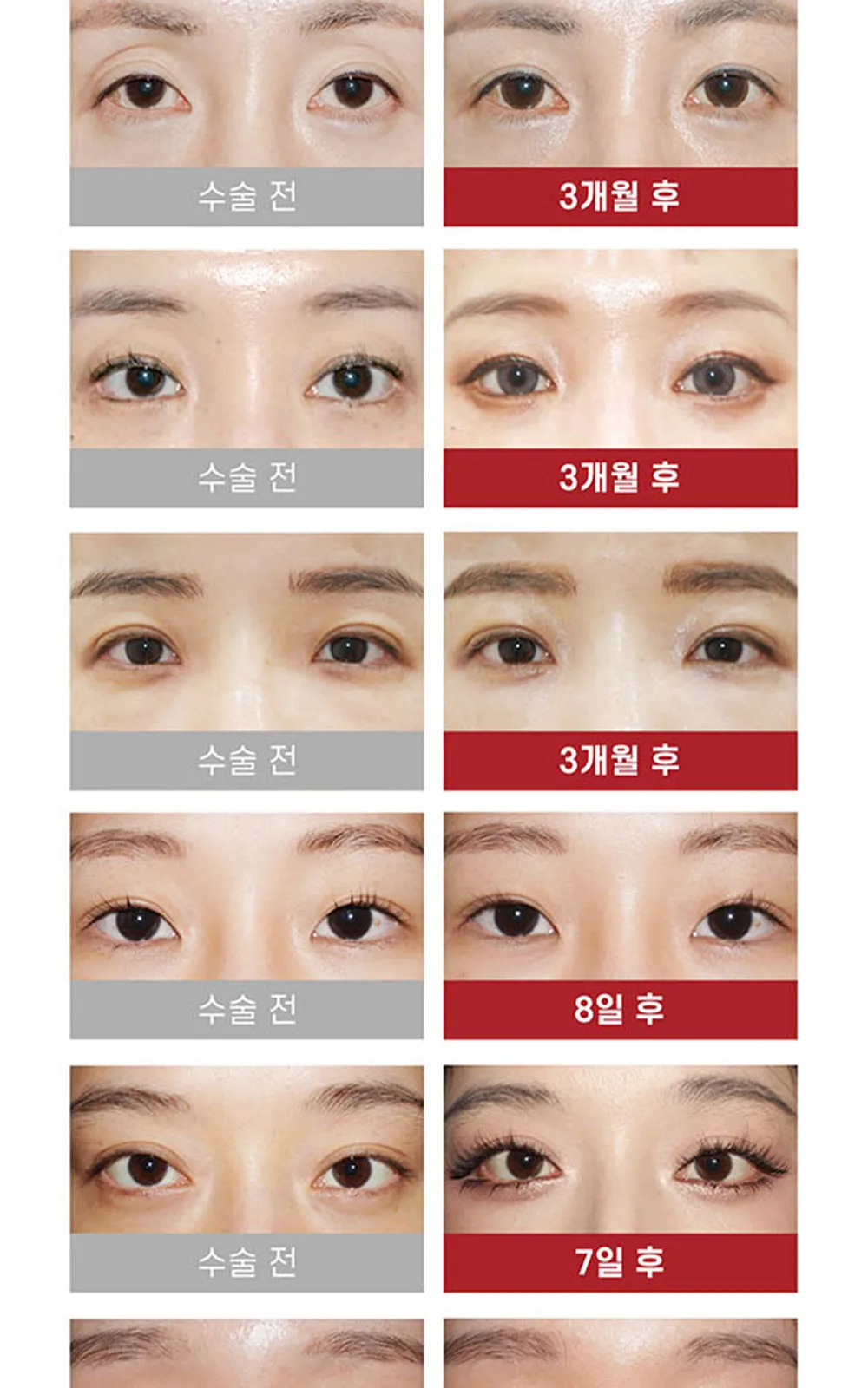 시술 상세 8