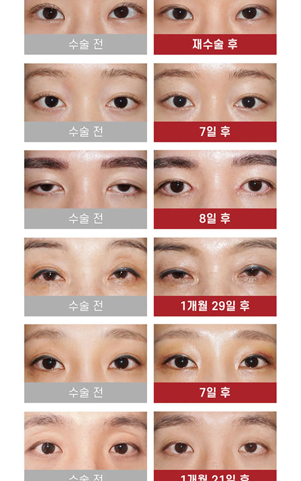 시술 상세 9