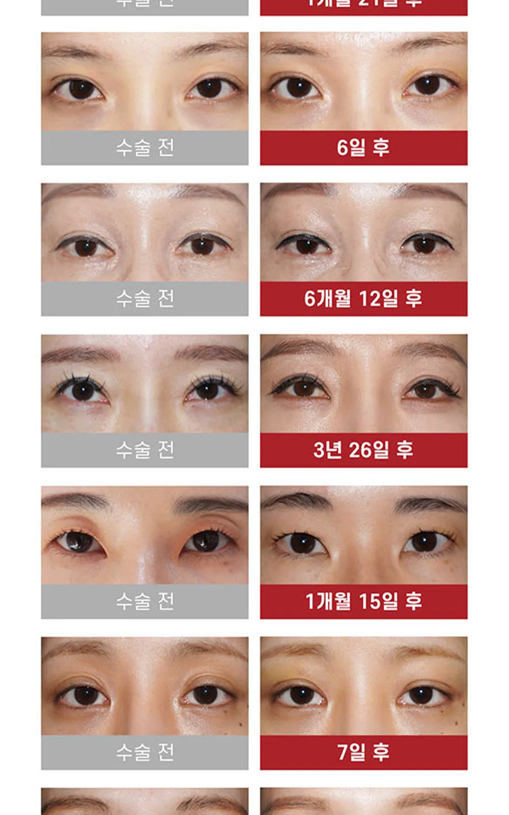 시술 상세 10