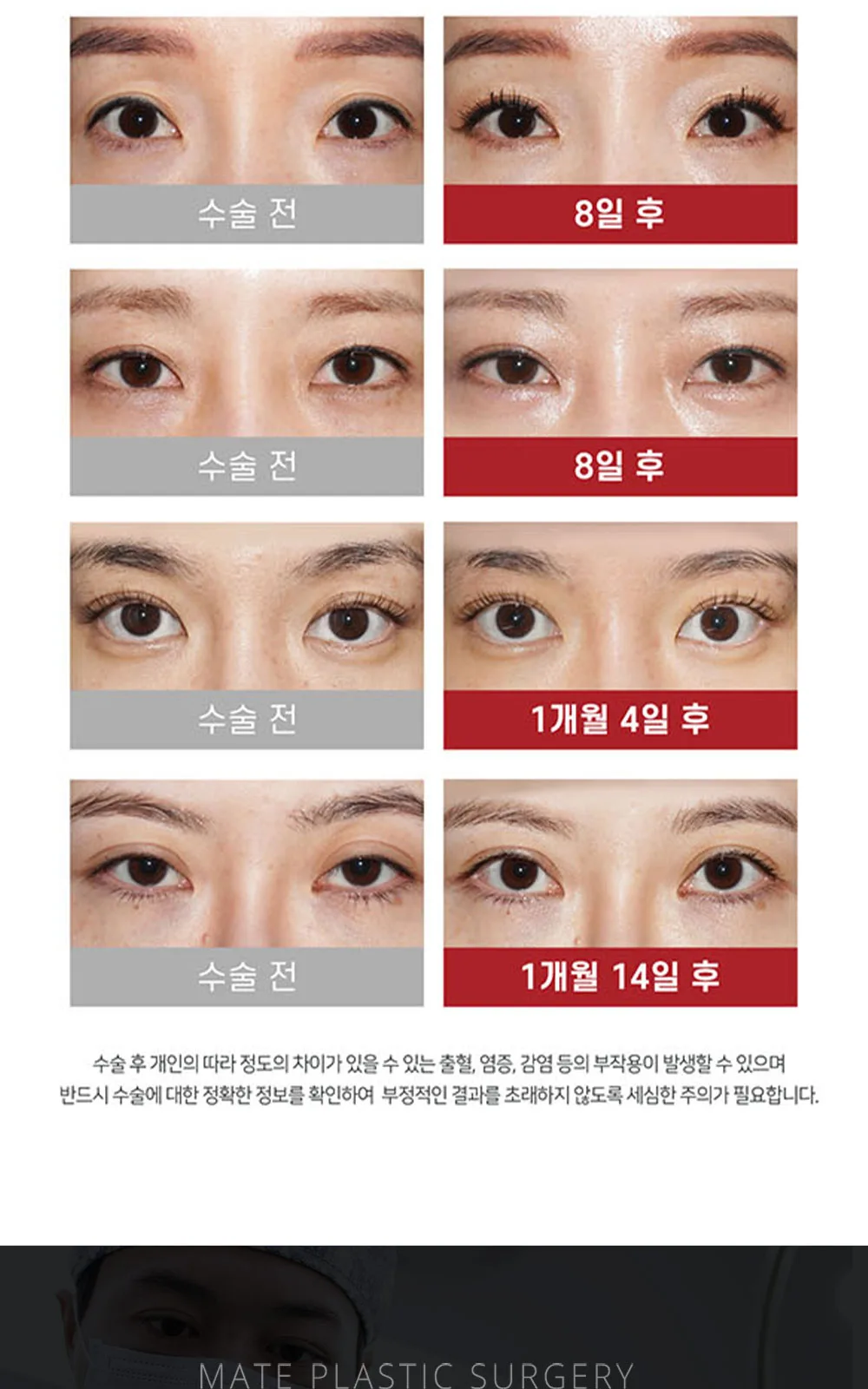 시술 상세 13