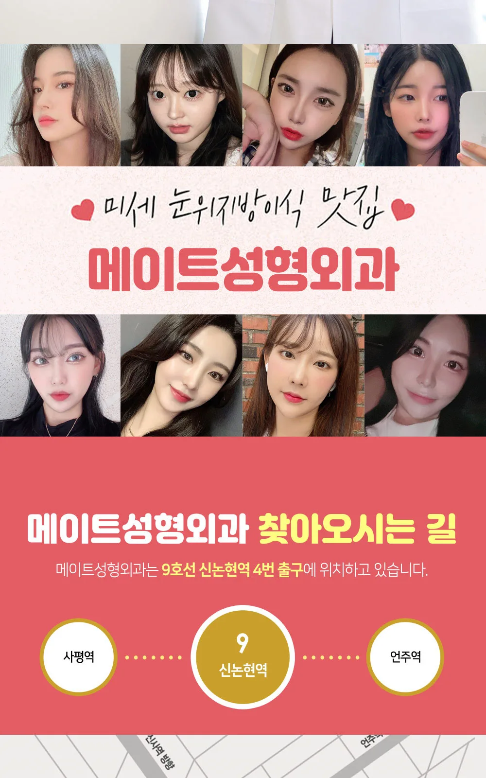 시술 상세 15