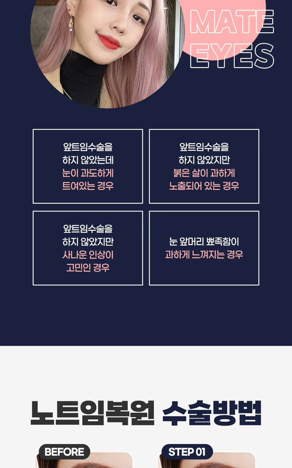 시술 상세 3