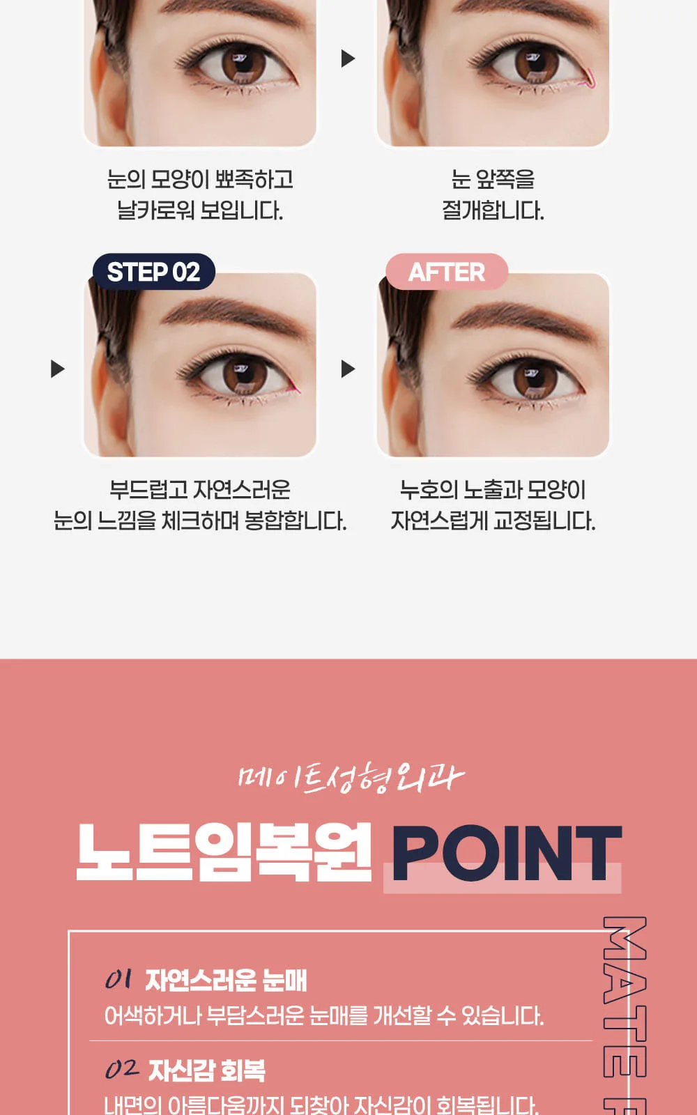 시술 상세 4