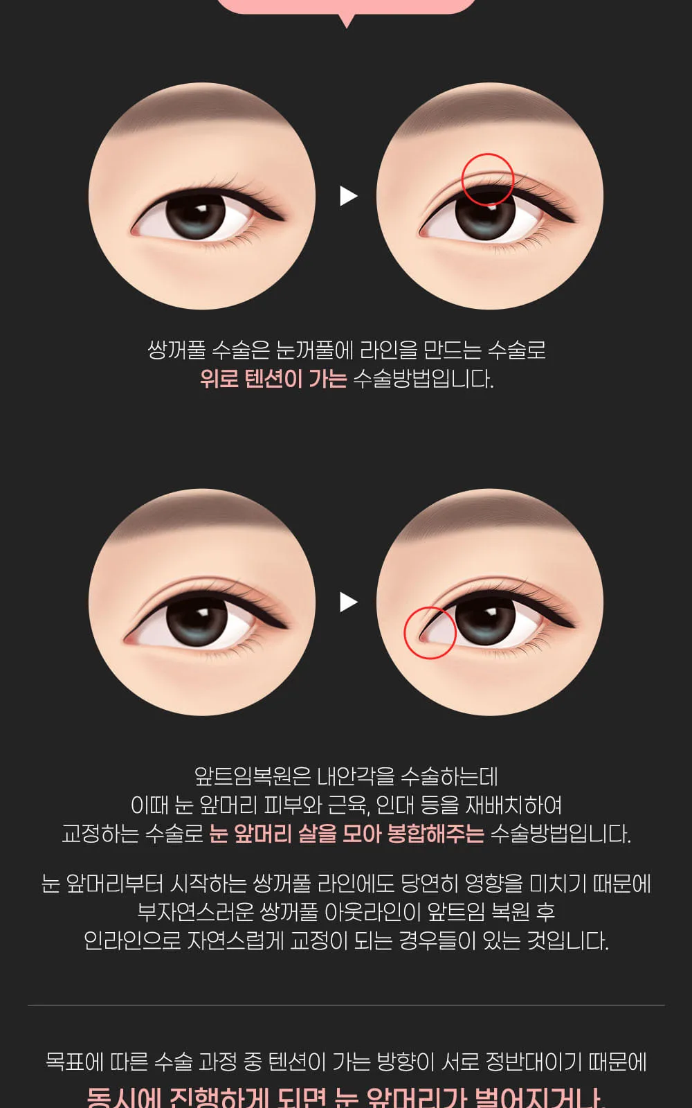 시술 상세 6