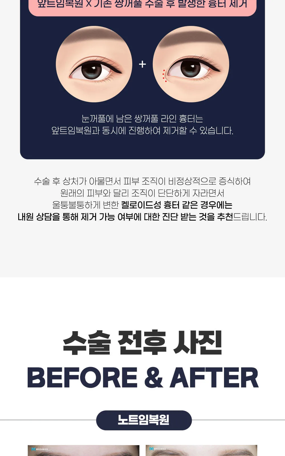 시술 상세 9