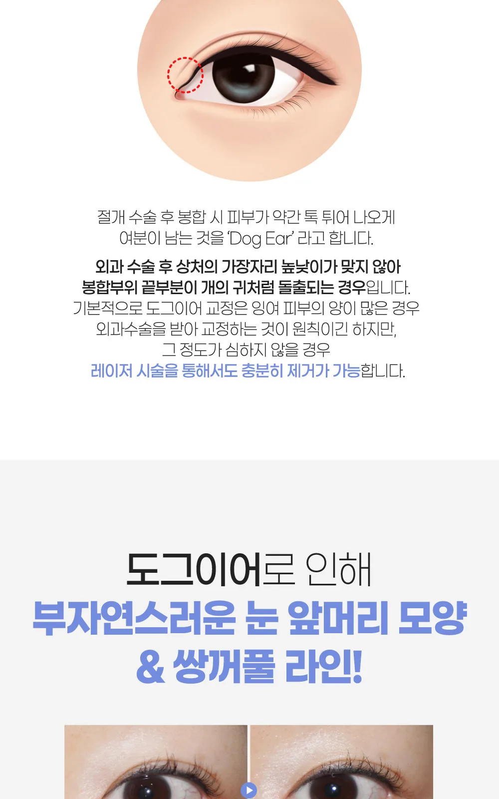 시술 상세 2