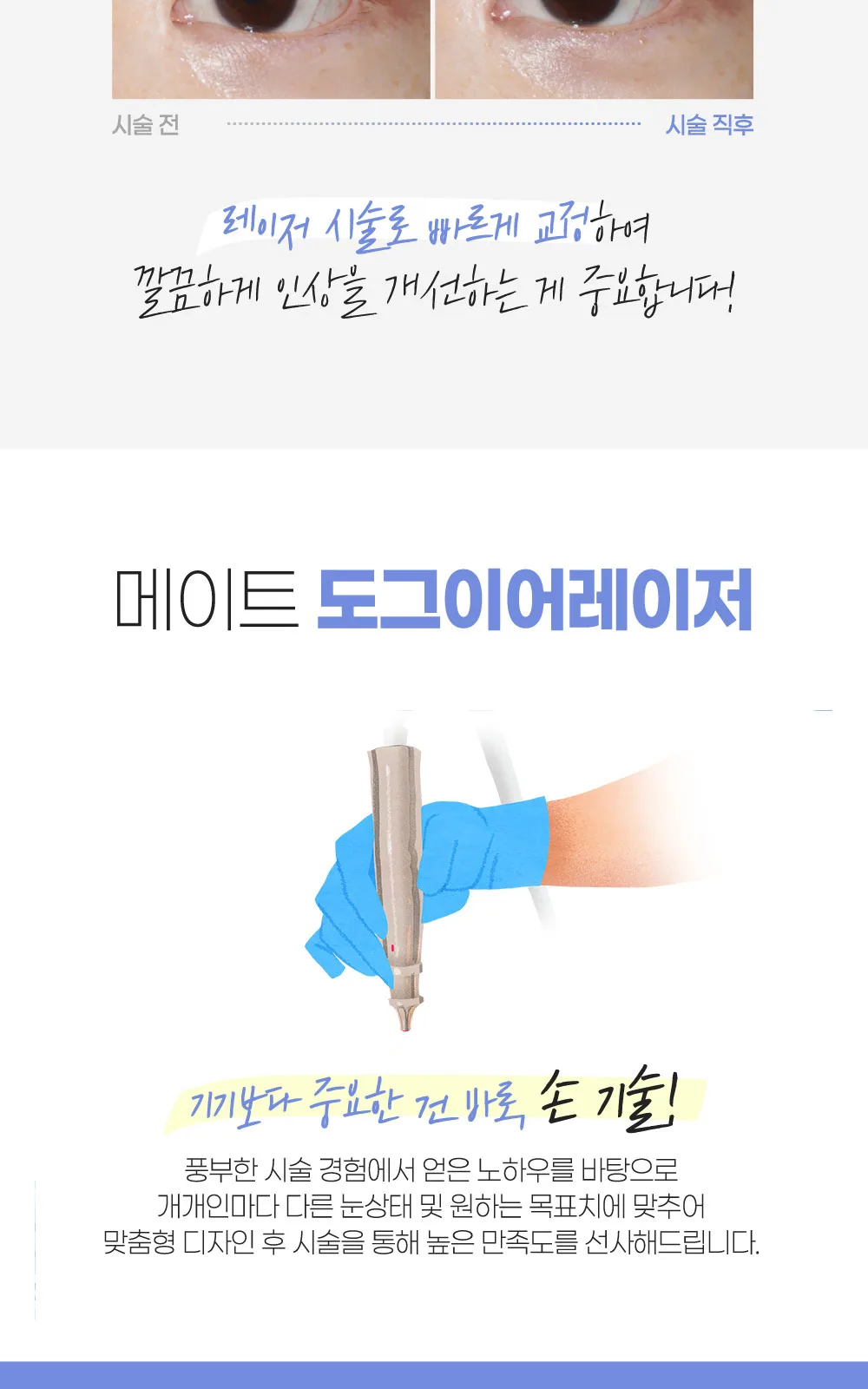 시술 상세 3